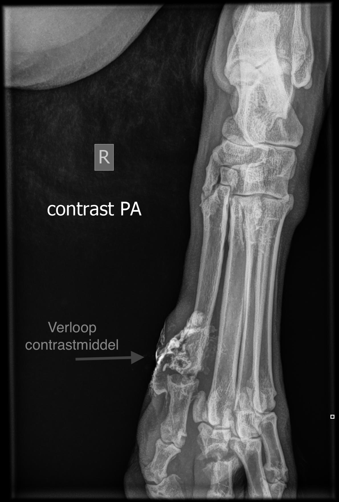 Ondervoet PA contrast Muk Verbakel 02 08 2025