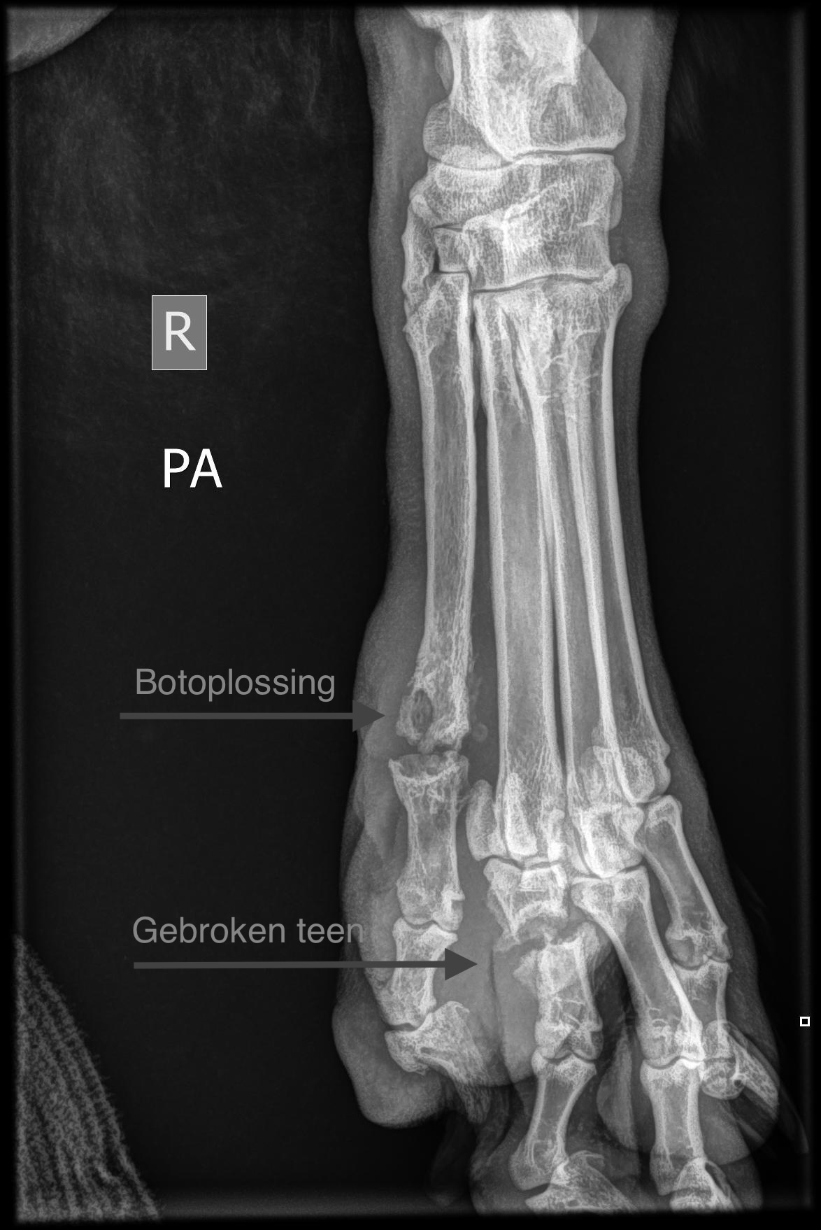 Ondervoet PA natief Muk Verbakel 02 08 2025